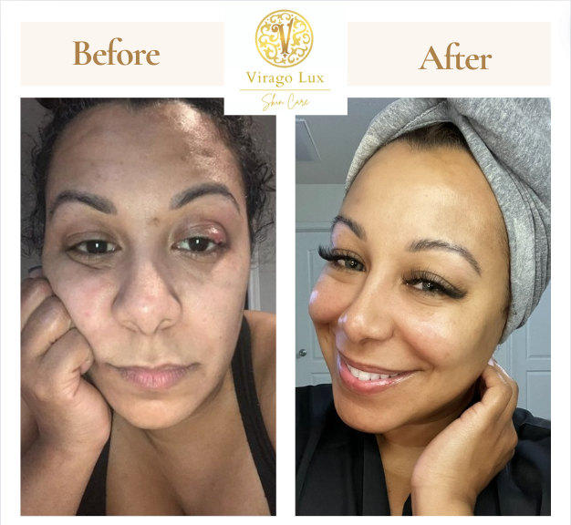 Pure Essence Face Serum